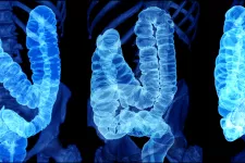 Blue imaging of intestinal, colon, rectum from 3 different angels