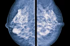 mammary imaging screening picture